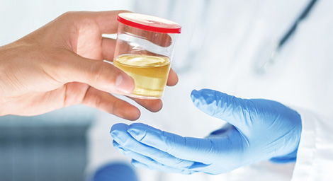  Jämföra de viktigaste egenskaperna för drogtestningsmetoder med urin och saliv