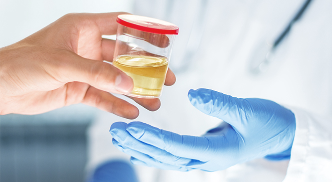 Comparing the key qualities  Of urine, oral fluid and hair  Drug testing methods
